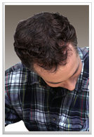 خرید پودر پرپشت کننده موی سر تاپیک اصل hi hair ساخت آلمان 