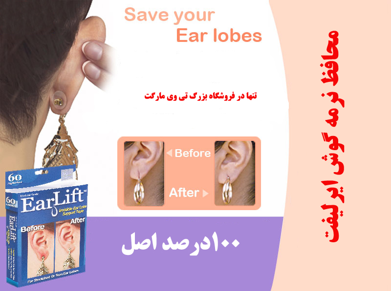 خرید پروتز محافظ نرمه گوش و درمان لاله گوش ایر لیفت EARLIFT