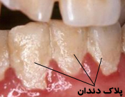 مسواک مگنتی آنتی باکتریال , مسواک مغناطیسی اصل