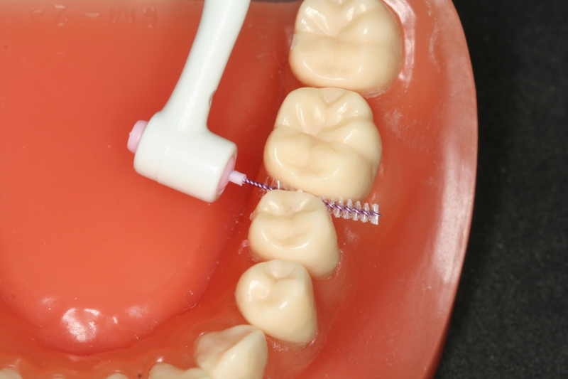 برس جرم گیر دندان رو و بین دندانی جدید اینتردنتال براش Interdental  Brush