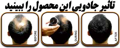 خرید پودر پرپشت کننده موی سر تاپیک اصل hi hair ساخت آلمان 